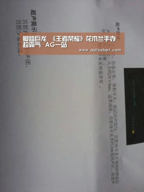 脚踏巨龙 《王者荣耀》花木兰手办超霸气-AG一站(图2) AG国际
